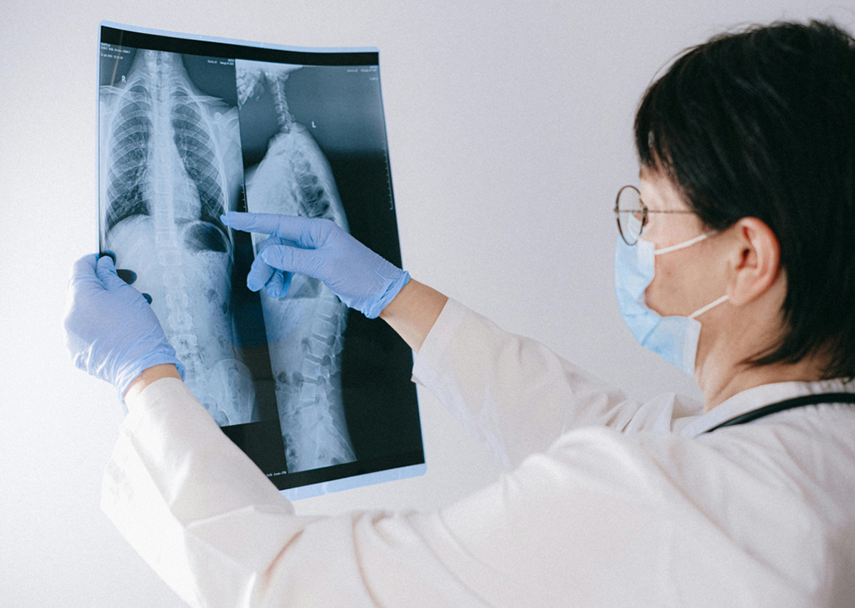 Polmoniti nosocomiali